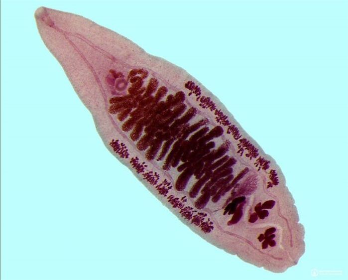 opisthorchiasis gizakietan