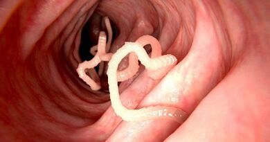 Gizakiaren gorputzean parasitoen arrazoiak