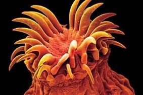 Trematodo parasitoak gizakietan