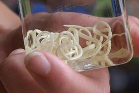 giza gorputzetik parasitoak